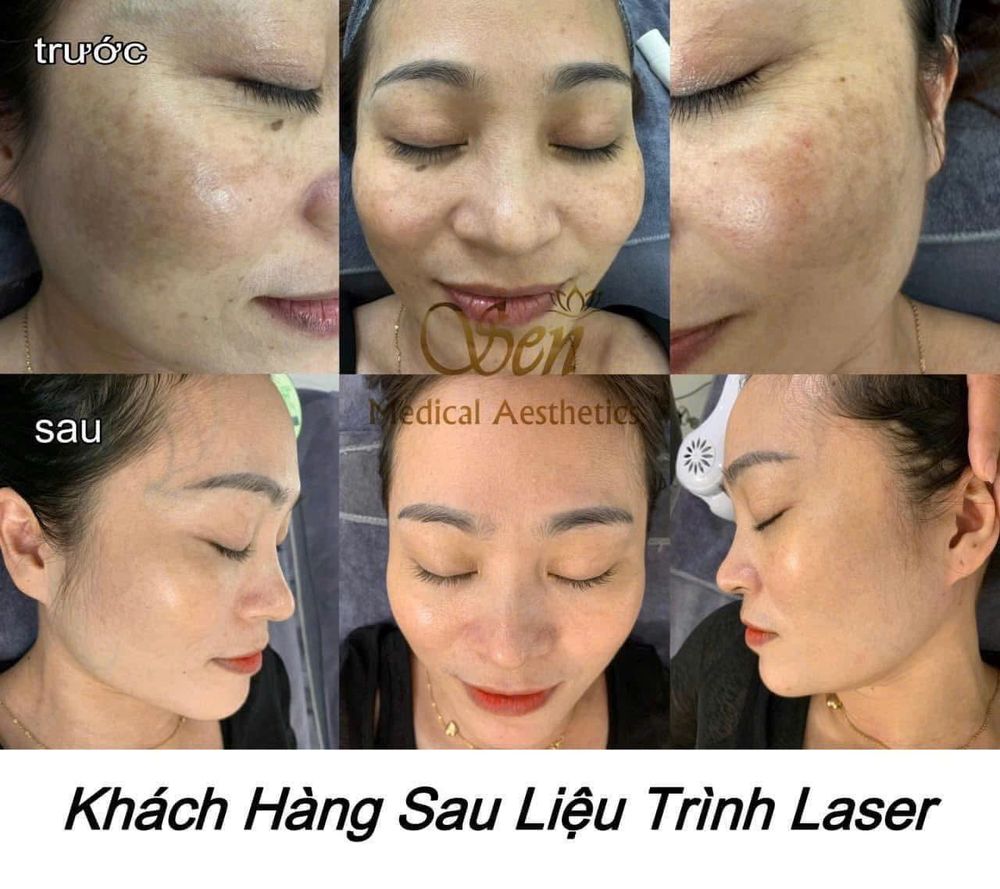 Khách hàng trải nghiệm liệu trình tại Thẩm Mỹ Sen